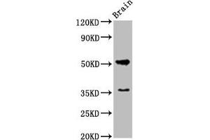 Western Blot Positive WB detected in: Rat brain tissue All lanes: Chrm1 antibody at 5.