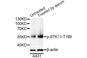 Western blot analysis of extracts of A431 cells, using Phospho-STK11-T189 antibody (ABIN5995630) at 1/1000 dilution. (LKB1 Antikörper  (pThr189))