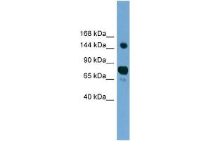 WB Suggested Anti-AGTPBP1 Antibody Titration: 0. (AGTPBP1 Antikörper  (N-Term))