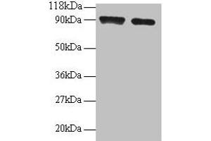 Western blot All lanes: SAT1 antibody at 2 μg/mL Lane 1: 293T whole cell lysate Lane 2: EC109 whole cell lysate Secondary Goat polyclonal to rabbit IgG at 1/15000 dilution Predicted band size: 21 kDa Observed band size: 90 kDa (SAT1 Antikörper  (AA 5-171))