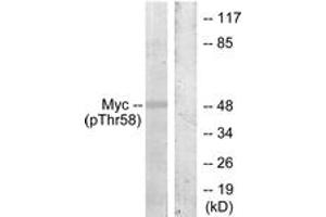 Western blot analysis of extracts from ovary cancer, using Myc (Phospho-Thr58) Antibody. (c-MYC Antikörper  (pThr58))
