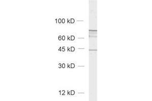 Western Blotting (WB) image for anti-ELK3, ETS-Domain Protein (SRF Accessory Protein 2) (ELK3) (AA 189-204) antibody (ABIN1742519) (ELK3 Antikörper  (AA 189-204))