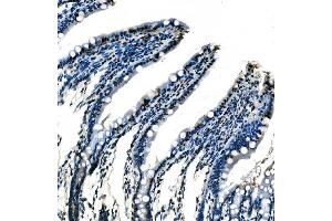 IHC analysis of splicing factor 1 using anti-splicing factor 1 antibody (ABIN7600193).