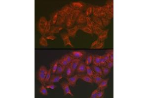 Immunofluorescence analysis of U2OS cells using [KO Validated] SOD2 Rabbit pAb (ABIN3021903, ABIN3021904, ABIN3021905 and ABIN6217382) at dilution of 1:200 (40x lens). (SOD2 Antikörper  (AA 25-222))