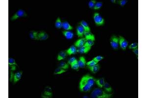 Immunofluorescence staining of Hela cells with ABIN7159205 at 1:66, counter-stained with DAPI. (MCHR2 Antikörper  (AA 1-39))