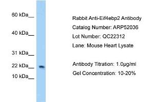 Western Blotting (WB) image for anti-Eukaryotic Translation Initiation Factor 4E Binding Protein 2 (EIF4EBP2) (N-Term) antibody (ABIN2784743)