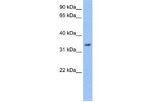 WB Suggested Anti-LACTB Antibody Titration: 0. (LACTB Antikörper  (Middle Region))