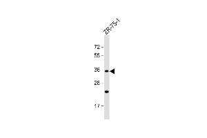 Anti-OR2L8 Antibody (C-term) at 1:1000 dilution + ZR-75-1 whole cell lysate Lysates/proteins at 20 μg per lane. (OR2L8 Antikörper  (C-Term))