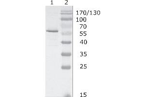 Western-Blot analysis of HIV-1 HAN subtype gag protein using HIV-1 p24 (05-001) antibody. (HIV-1 p24 Antikörper  (AA 48-62))