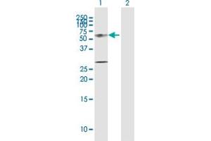 Western Blot analysis of KRT12 expression in transfected 293T cell line by KRT12 MaxPab polyclonal antibody.
