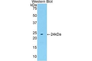 Western blot analysis of the recombinant protein. (FGF13 Antikörper  (AA 1-192))