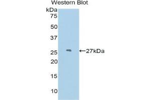 Detection of Recombinant PDCN, Mouse using Polyclonal Antibody to Podocin (PDCN) (Podocin Antikörper  (AA 138-371))