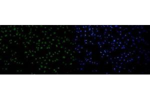 IF analysis of 53BP1/TP53BP1 using anti-53BP1/TP53BP1 antibody (ABIN7599869). (TP53BP1 Antikörper  (AA 1239-1972))