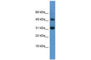 Image no. 1 for anti-Caspase 7, Apoptosis-Related Cysteine Peptidase (CASP7) (AA 107-156) antibody (ABIN6746543) (Caspase 7 Antikörper  (AA 107-156))