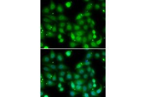 Immunofluorescence analysis of MCF-7 cells using RORA antibody. (RORA Antikörper)