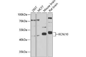 Western blot analysis of extracts of various cell lines, using KCNJ10 Antibody (ABIN6134092, ABIN6142719, ABIN6142720 and ABIN6225135) at 1:1000 dilution. (KCNJ10 Antikörper  (AA 50-150))
