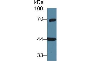 Western blot analysis of Rat Cerebrum lysate, using Human GNa11 Antibody (1 µg/ml) and HRP-conjugated Goat Anti-Rabbit antibody ( (GNA11 Antikörper  (AA 1-359))