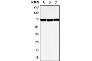 Western blot analysis of GPR50 expression in HeLa (A), SP2/0 (B), PC12 (C) whole cell lysates. (GPR50 Antikörper  (Center))