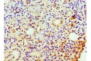 Immunohistochemistry of paraffin-embedded human pancreatic tissue using ABIN7147891 at dilution of 1:100 (CLDN14 Antikörper  (AA 140-239))