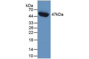 Detection of Recombinant PAI1, Human using Monoclonal Antibody to Plasminogen Activator Inhibitor 1 (PAI1) (PAI1 Antikörper)