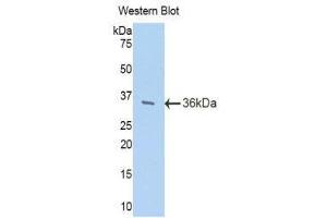 Western Blotting (WB) image for anti-Trefoil Factor 3 (Intestinal) (TFF3) (AA 23-81) antibody (ABIN1078618)