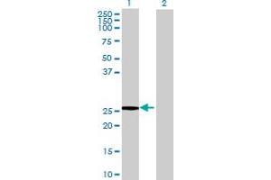 Western Blotting (WB) image for APOBEC3B 293T Cell Transient Overexpression Lysate(Denatured) (ABIN1334606)