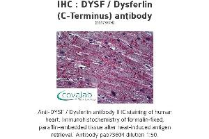 Image no. 1 for anti-Dysferlin (DYSF) (C-Term) antibody (ABIN2852394) (Dysferlin Antikörper  (C-Term))