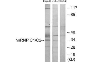 Western Blotting (WB) image for anti-Heterogeneous Nuclear Ribonucleoprotein C (C1/C2) (HNRNPC) (C-Term) antibody (ABIN1849120) (HNRNPC Antikörper  (C-Term))