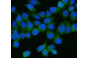 IF analysis of AP2M1 using anti-AP2M1 antibody (ABIN7602628).