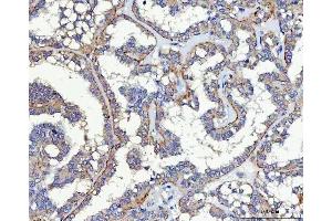 IHC analysis of SLC17A5 using anti-SLC17A5 antibody (ABIN7599315).