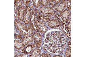 Immunohistochemical staining (Formalin-fixed paraffin-embedded sections) of human kidney shows strong cytoplasmic positivity in renal tubules.