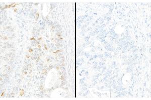 Immunohistochemistry (IHC) image for anti-Tripartite Motif Containing 28 (TRIM28) (pSer824) antibody (ABIN7455183)