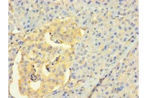 Immunohistochemistry of paraffin-embedded human pancreatic tissue using ABIN7158857 at dilution of 1:100 (CDC25C Antikörper  (AA 1-473))