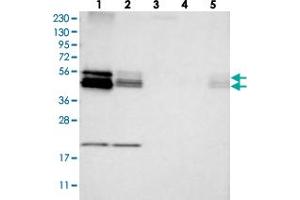 Western blot analysis of Lane 1: RT-4, Lane 2: U-251 MG, Lane 3: Human Plasma, Lane 4: Liver, Lane 5: Tonsil with BNIP2 polyclonal antibody . (BNIP2 Antikörper)