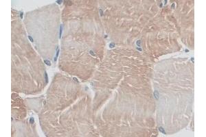 Detection of MYO1D in Rat Skeletal muscle Tissue using Polyclonal Antibody to Myosin ID (MYO1D) (Myosin ID Antikörper  (AA 512-788))