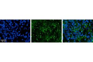 Rabbit Anti-ZDHHC17 Antibody     Formalin Fixed Paraffin Embedded Tissue: Human Pineal Tissue  Observed Staining: Cytoplasmic in vesicles and processes of pinealocytes  Primary Antibody Concentration: 1:100  Secondary Antibody: Donkey anti-Rabbit-Cy3  Secondary Antibody Concentration: 1:200  Magnification: 20X  Exposure Time: 0. (ZDHHC17 Antikörper  (Middle Region))
