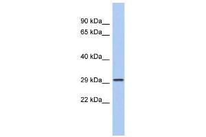 WB Suggested Anti-CACNG6 Antibody Titration:  0. (CACNG6 Antikörper  (N-Term))