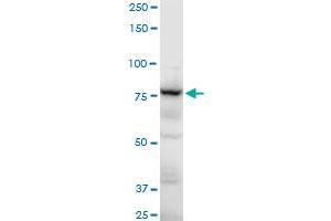 Western Blotting (WB) image for anti-Adducin 3 (Gamma) (ADD3) (AA 462-560) antibody (ABIN559788)