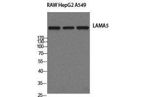 Western Blot analysis of RAW264. (Laminin alpha 5 Antikörper)