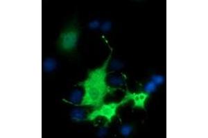 Anti-BEST3 mouse monoclonal antibody (ABIN2452806) immunofluorescent staining of COS7 cells transiently transfected by pCMV6-ENTRY BEST3 (RC218436). (Bestrophin 3 Antikörper)