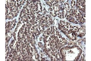 Image no. 5 for anti-V-Ets Erythroblastosis Virus E26 Oncogene Homolog 2 (ETS2) (AA 90-349) antibody (ABIN1491703)