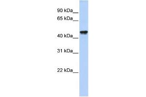 WB Suggested Anti-QTRTD1 Antibody Titration:  0. (QTRTD1 Antikörper  (N-Term))