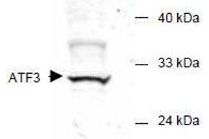 Image no. 1 for anti-Activating Transcription Factor 3 (ATF3) (AA 113-130) antibody (ABIN401262) (ATF3 Antikörper  (AA 113-130))