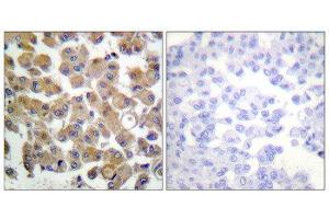 Immunohistochemistry (IHC) image for anti-Transforming Growth Factor, beta 1 (TGFB1) (C-Term) antibody (ABIN1848794) (TGFB1 Antikörper  (C-Term))