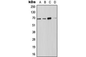 Western blot analysis of NOX4 expression in JAR (A), Jurkat (B), SP2/0 (C), PC12 (D) whole cell lysates. (NADPH Oxidase 4 Antikörper  (N-Term))