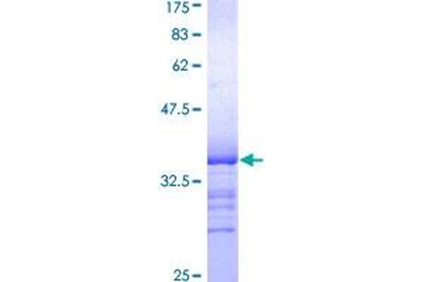 NR4A1 Protein (AA 191-280) (GST tag)