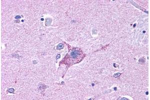 Anti-NPY5R antibody  ABIN1049125 IHC staining of human brain, neurons and glia. (NPY5R Antikörper  (Cytoplasmic Domain))