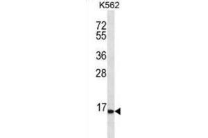Western Blotting (WB) image for anti-Serine Peptidase Inhibitor, Kazal Type 8 (SPINK8) antibody (ABIN2996842) (SPINK8 Antikörper)