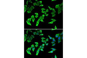 Immunofluorescence analysis of U2OS cell using MLH1 antibody. (MLH1 Antikörper)