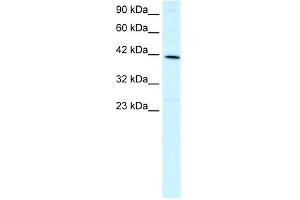 WB Suggested Anti-FOXF2 Antibody Titration: 1. (FOXF2 Antikörper  (N-Term))